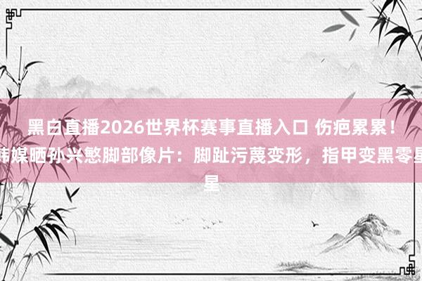 黑白直播2026世界杯赛事直播入口 伤疤累累!韩媒晒孙兴慜脚部像片:脚趾污蔑变形,指甲变黑零星
